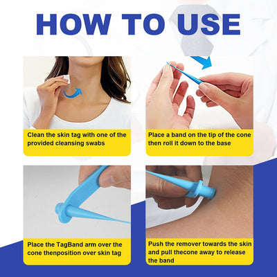 Skin Tag Removal Kit - 2-in-1 Silicone Band Ligation System for Safe Home Use
